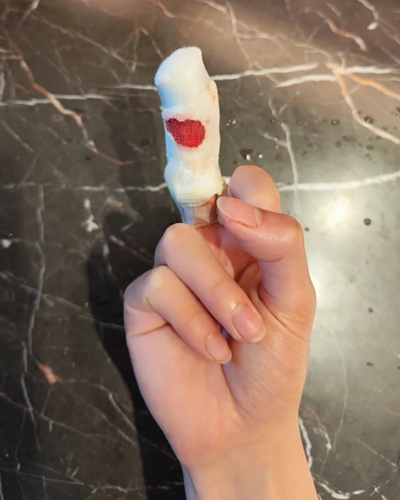 middle finger dp 21
